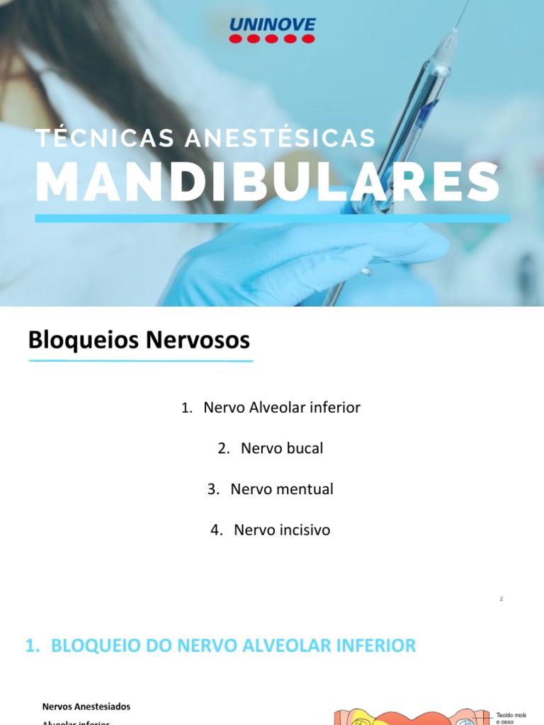 Técnicas de Anestesia Mandibular | PDF | Boca | Dente