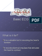 Basic ECG