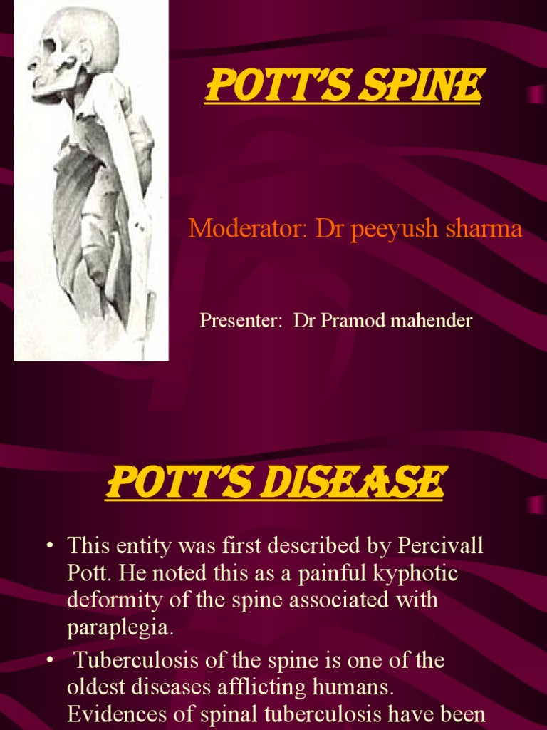 Pott Disease 1223292121651385 8 PDF