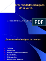 Patologia Benigna de Vulva