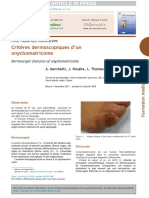 Critères Dermoscopiques D'Un Onychomatricome: Sciencedirect