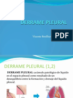 derramepleural