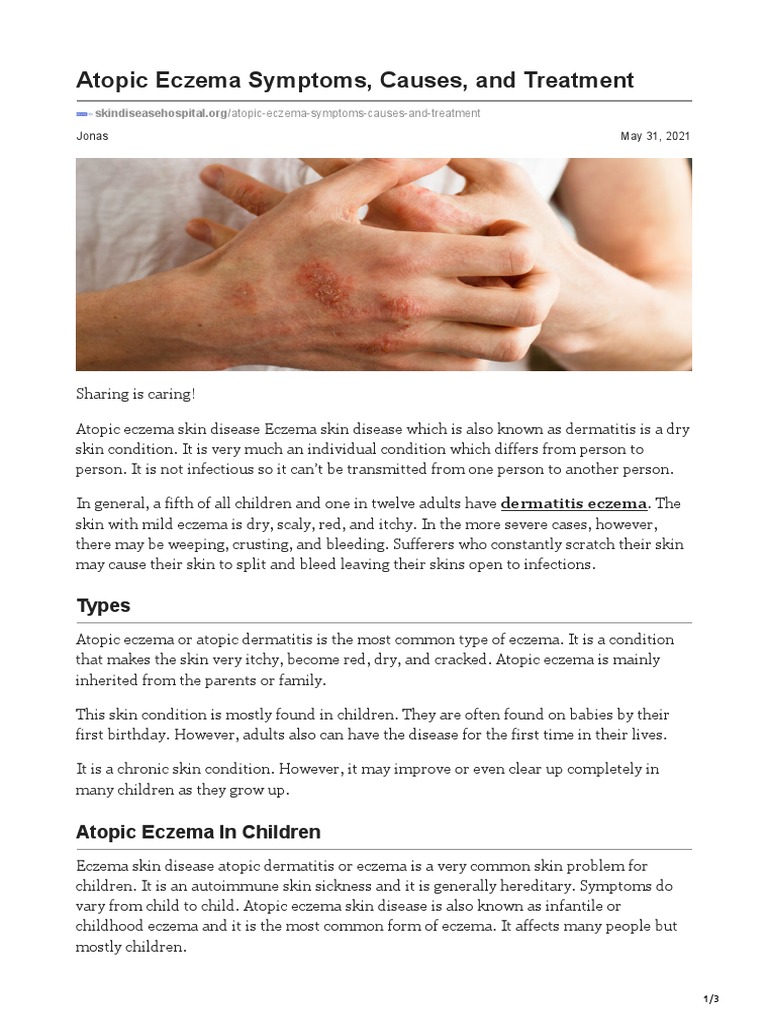 Atopic Eczema Symptoms Causes and Treatment | PDF | Dermatitis | Immune ...