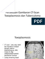 Perbedaan Gambaran CT-Scan Toxoplasmosis Dan Tuberculoma