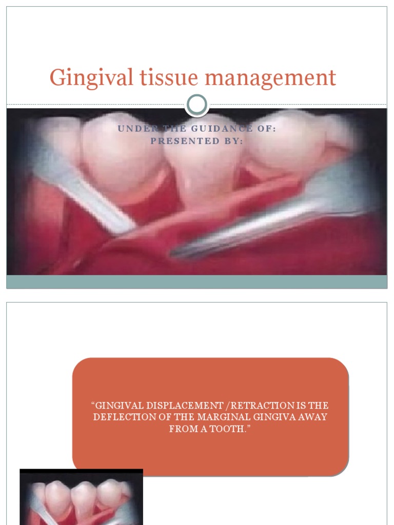 Gingival Tissue Management