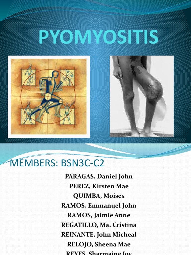 Understanding Pyomyositis in Children | PDF | Human Leg | Pelvis