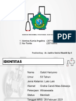 BPPV Lapsus