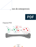 Imágenes de Osteoporosis