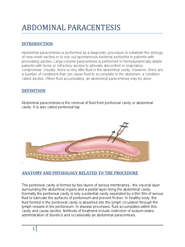 Abdominal Paracentesis Procedure Guide | PDF | Peritoneum | Abdomen