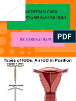 Demontrasi Cara Pemasangan Alat KB (Iud)