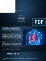 Cancerul-pulmonar