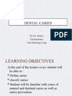 Dental Caries by DR - Sania.pptx Version 1