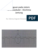 disritmia jantung