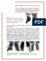 Módulo 2 - TBC y Cardiopatía