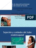 Tubo Endotraqueal