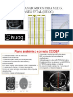 Reparos Anatomicos para Medir Craneo Fetal (Isuog