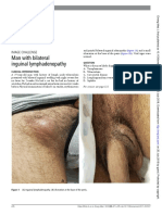 Man With Bilateral Inguinal Lymphadenopathy: Image Challenge