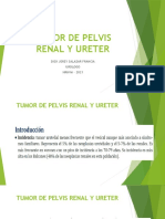 Tumor de Pelvis Renal y Ureter
