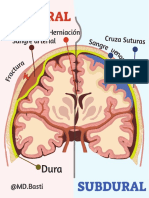 Epidural VS Subdural2