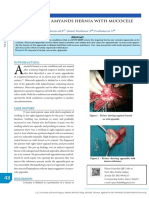 A R Are Case of Amyands Hernia With Mucocele Appendix