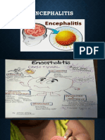 ENCEPHALITIS