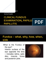 Fundus Exam: Interior Surface of the Eye Opposite the Lens