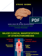 Stroke Iskemik