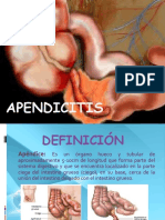 Apendicitis 