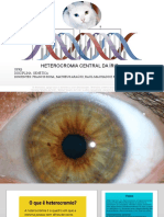 Heterocromia Central Da Íris