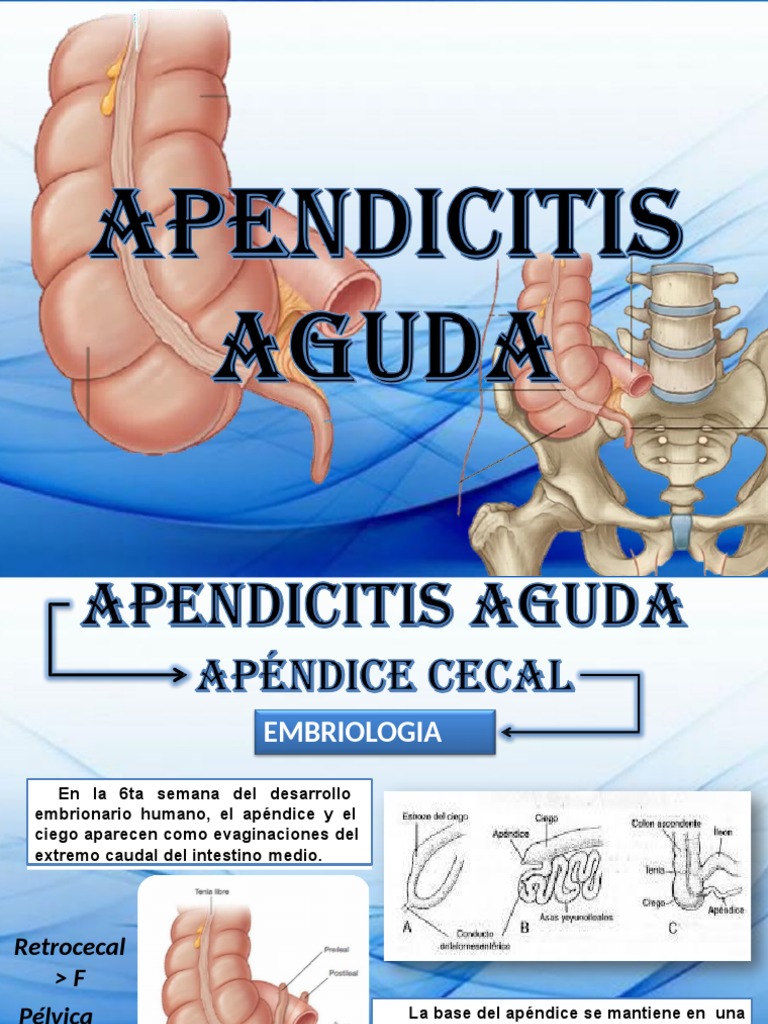APENDICITIS Páginas 2 15 | PDF | Gastroenterología | Enfermedades y  trastornos, image size:768x1024