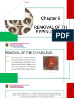 Removal of TH E Epinucleus