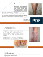 Caso Clinico - Psoriasis