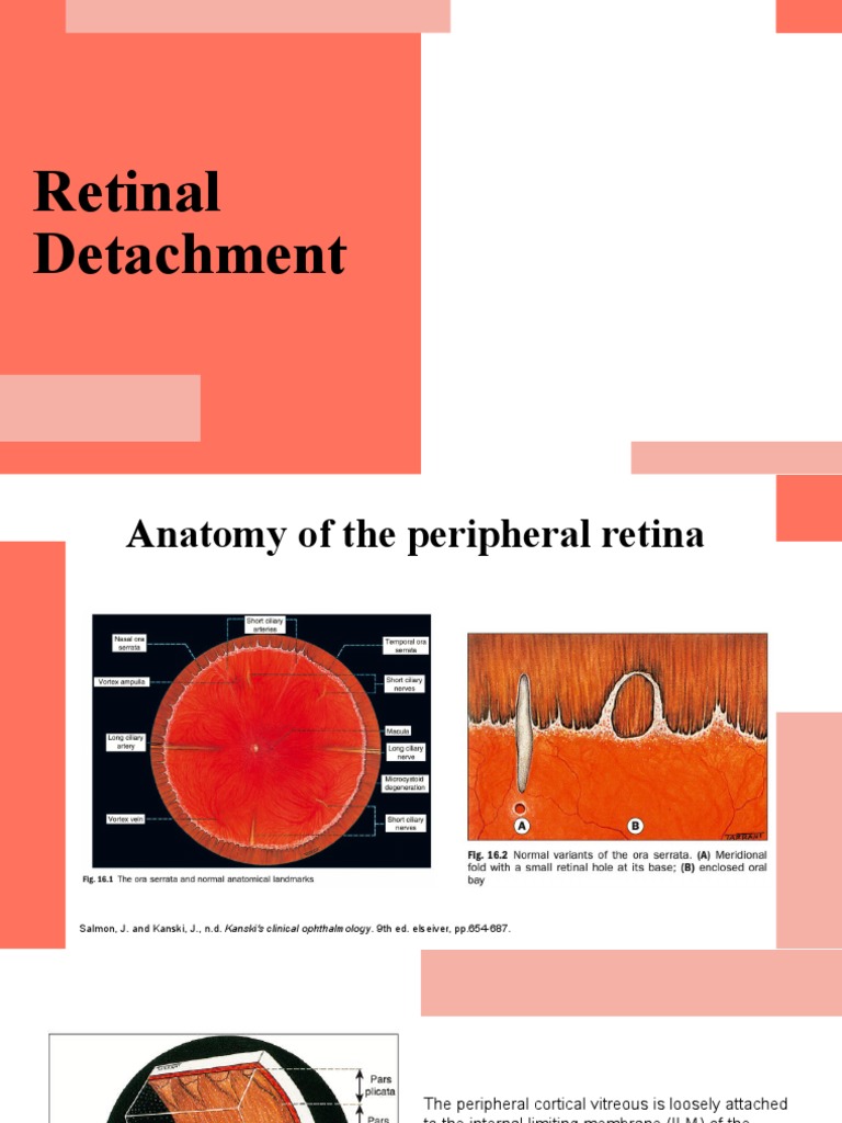 Retinal Detachment Slide | PDF | Diseases Of The Eye And Adnexa | Eye