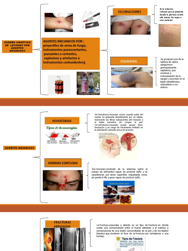 Cuadro Sinoptico de Agentes Mecanicos de Medicina Forense | PDF | Piel