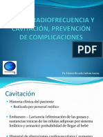 cavitacion__radiogalvan