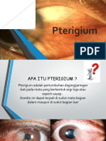 Pterigium penyebab dan cara mencegahnya