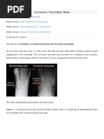 Accessory Navicular Bone