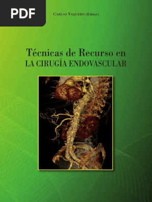 Tecnicas De Recurso En La Cirugia Endovascular Pdf Stent Angiologia