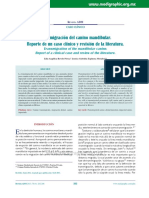 Transmigración Del Canino Mandibular. Reporte de Un Caso Clínico y Revisión de La Literatura