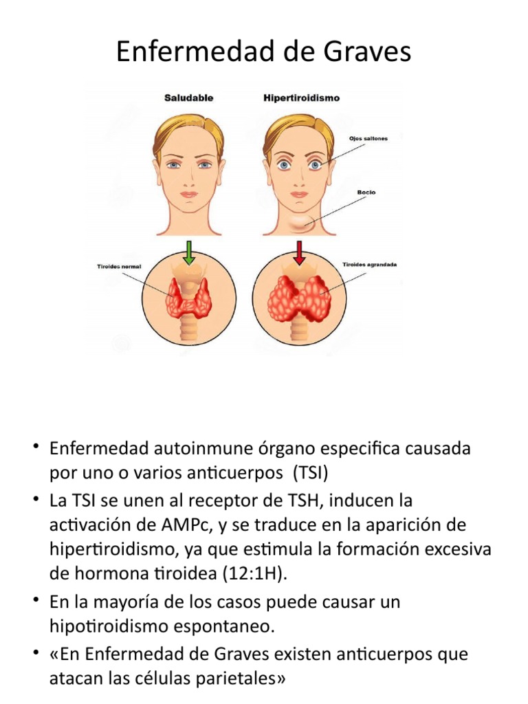 ENFERMEDAD DE GRAVES SINTOMAS intelligence overview