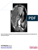 CT Scan Trauma Hepar 