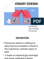 Pulmonary Edema: Presented By: Miss. M.K.Kakku Nursing Tutor