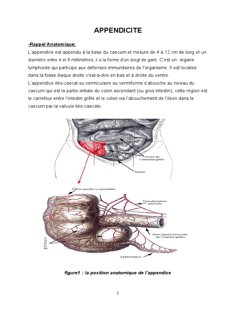 Appendicite : Diagnostic et Traitement | PDF | Spécialités médicales ...