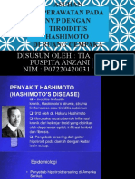 Hashimoto Tiroiditis