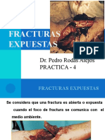 PRACTICA-FRACTURAS-EXPUESTAS (1)