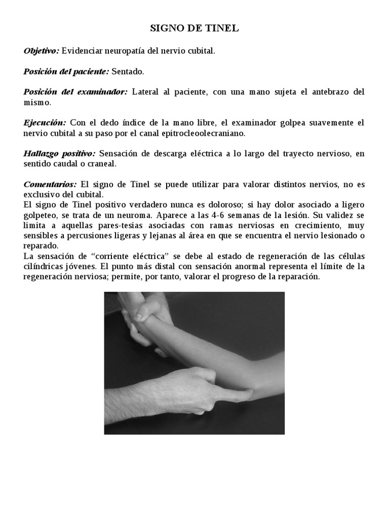 Signo de Tinel en Neuropatía Cubital | PDF | Relaciones personales ...