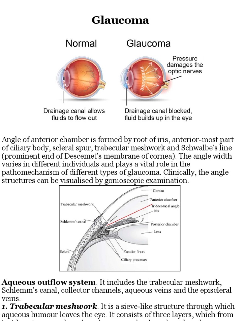 Glaucoma Pdf Glaucoma Retina