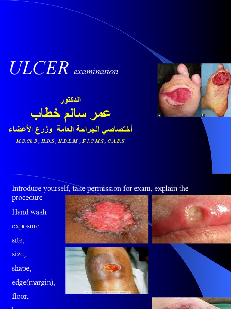 Lump Examination | PDF