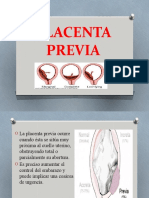 6 Placenta Previa