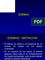 EDEMAS